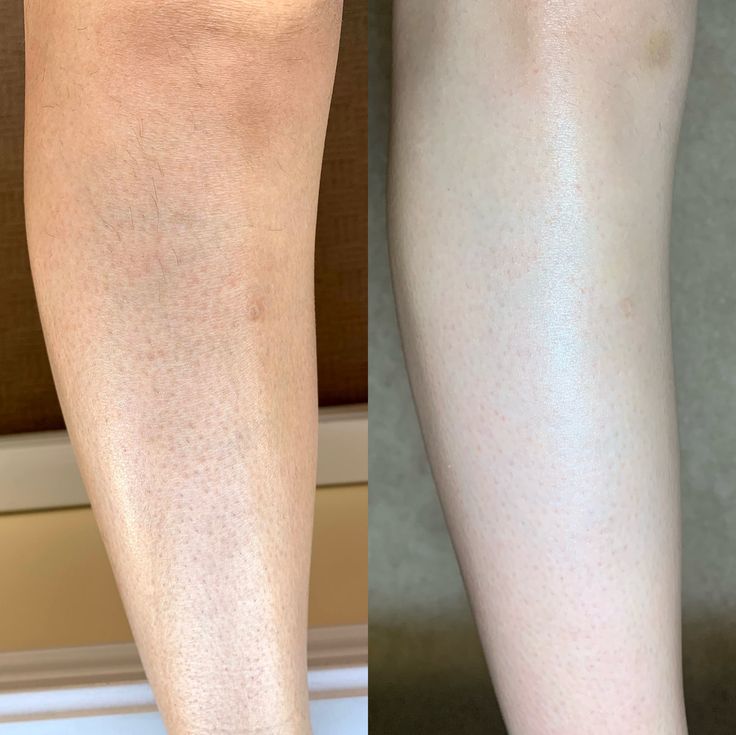 Turmeric & Kojic Acid Body Sugar Scrub