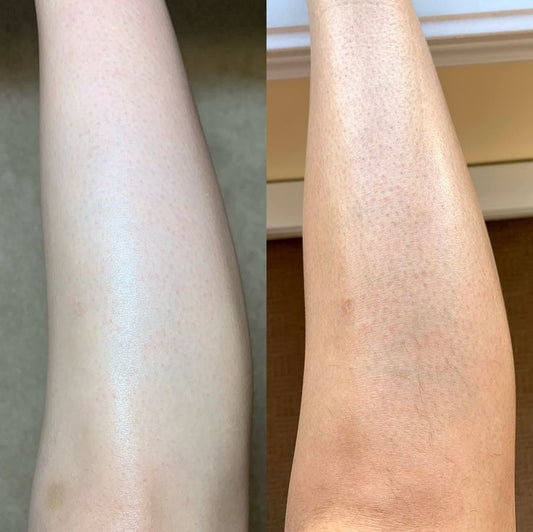 Turmeric & Kojic Acid Body Sugar Scrub