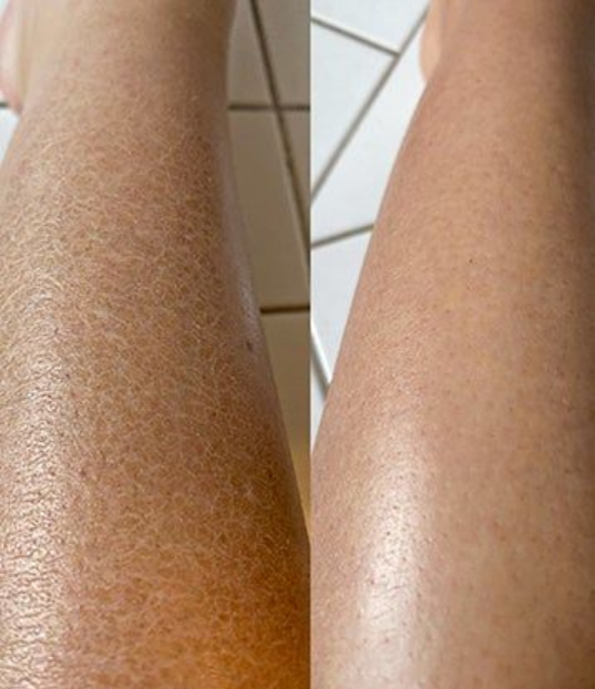 Turmeric & Kojic Acid Body Sugar Scrub