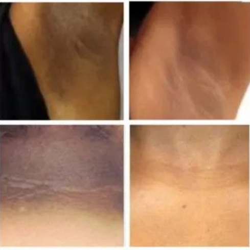 Glow Bundle of Turmeric & Kojic Acid Scrub and Soap