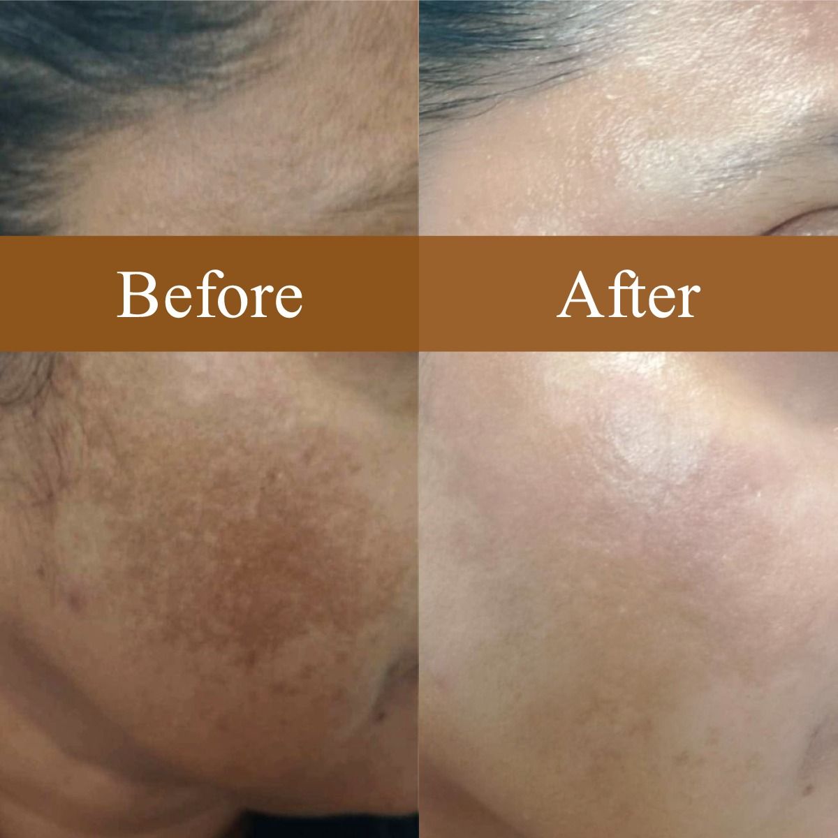 Glow Bundle of Turmeric & Kojic Acid Scrub and Soap